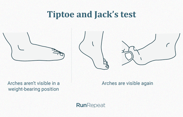 Instructional diagram demonstrating the Tiptoe and Jack's test for identifying foot arch flexibility and rigidity.