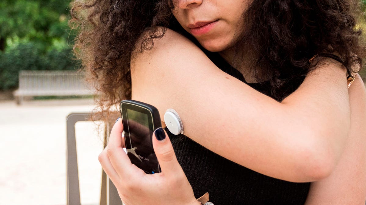 Top Wearable Glucose Monitors: 2026 Comparison Guide