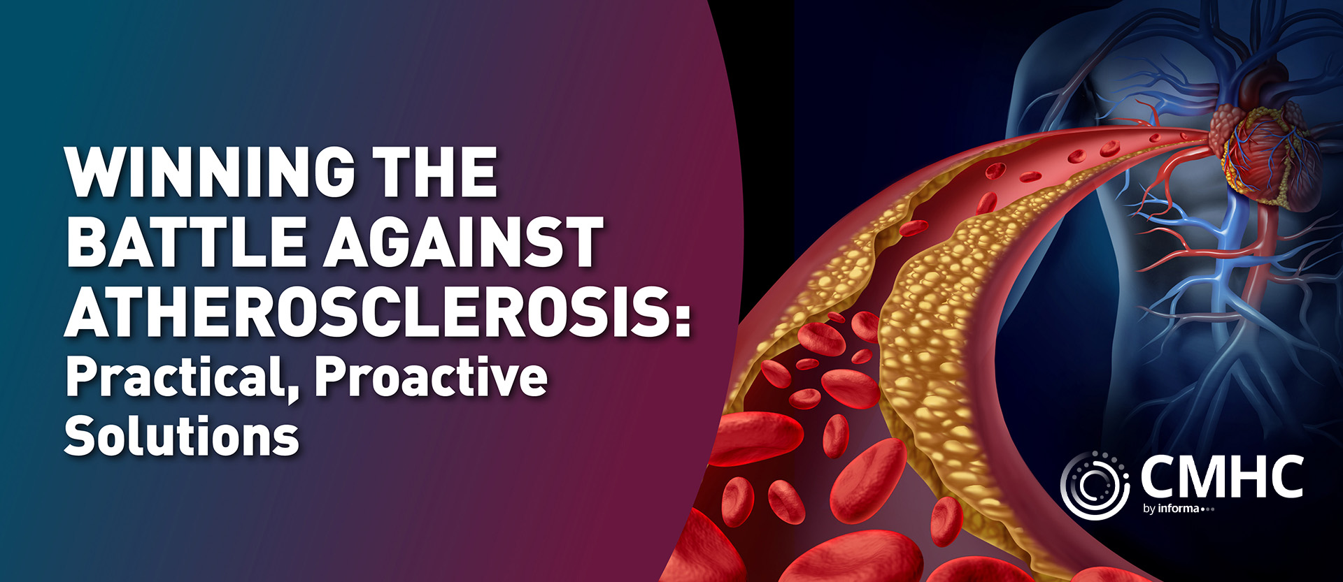 Arterial Health Guide: Preventing Atherosclerosis