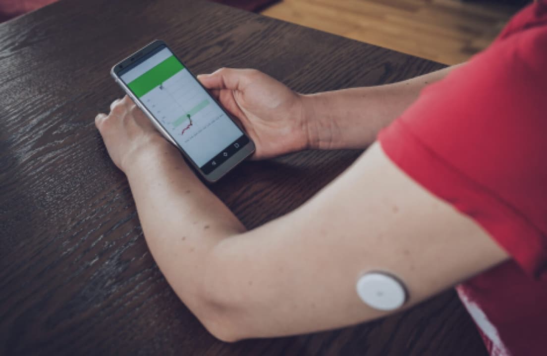The Dexcom G7 wearable sensor shown against a neutral background.