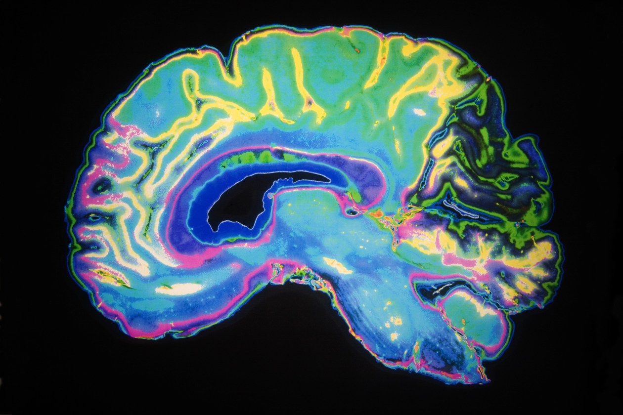 Alzheimer's Injection Treatment for At-Home Use
