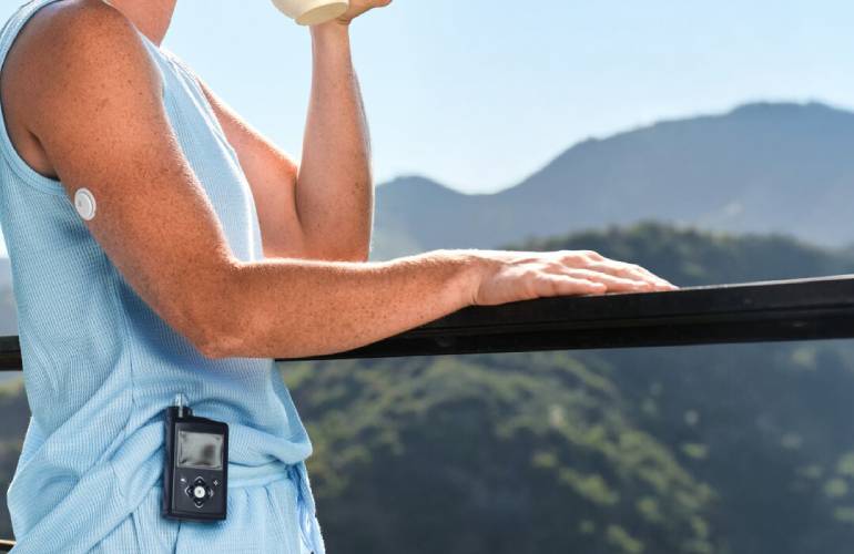 A MiniMed Instinct CGM sensor designed for 15-day wear.