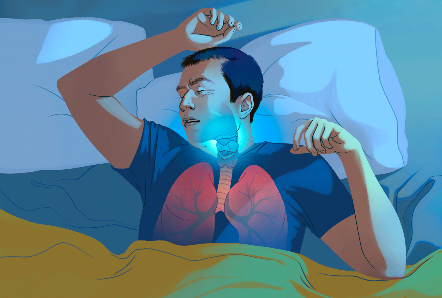 A medical illustration highlighting the throat and lung anatomy of a sleeping individual to show potential points of airway collapse.