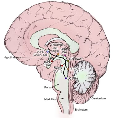 Diagram showing the VLPO nucleus and its inhibitory projections to the brain's arousal system.