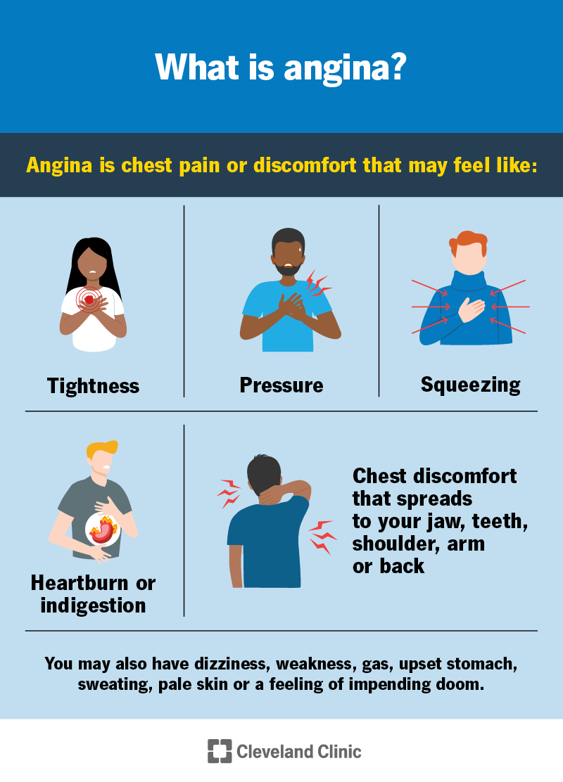 3 Types of Angina: A Guide to Heart Disease Signs